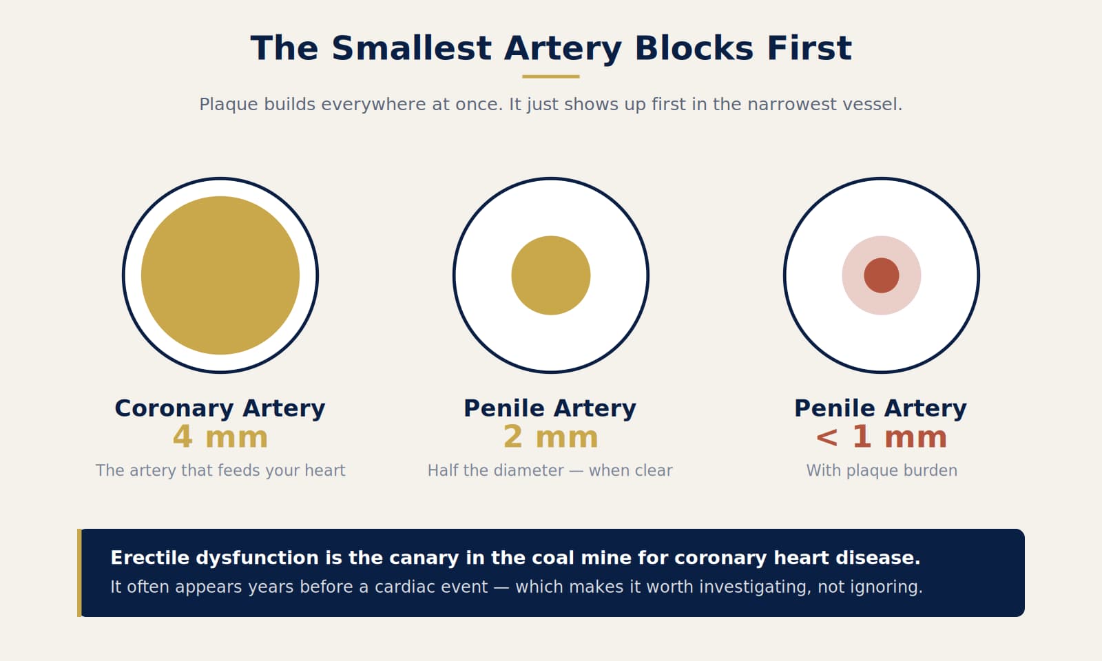 Comparison of coronary artery and penile artery diameter showing why erectile dysfunction is an early warning sign of heart disease