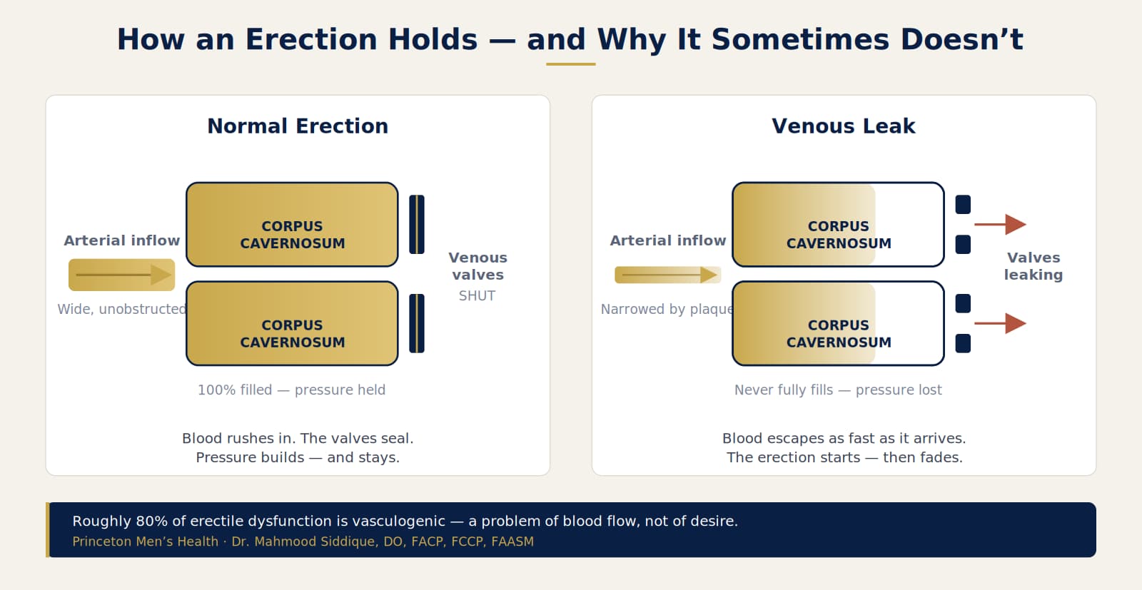Diagram showing normal erectile blood flow compared with venous leak