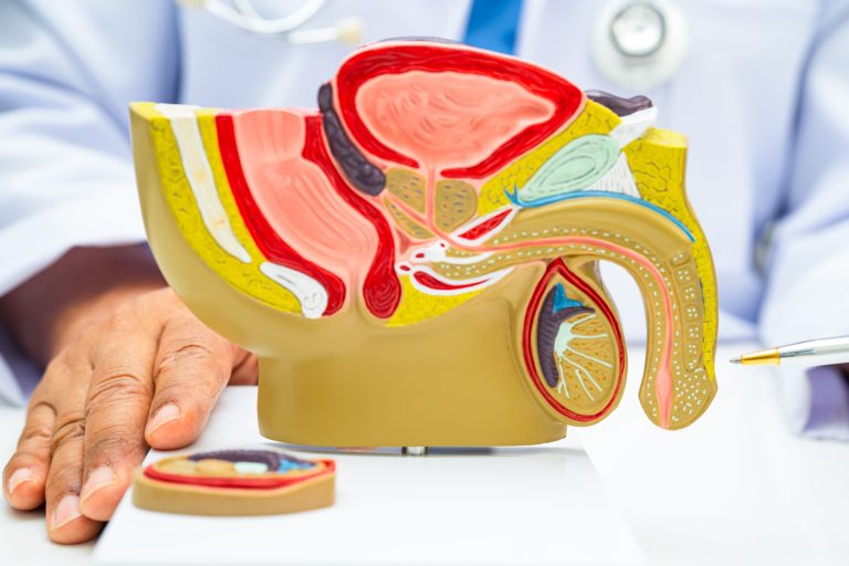 Peyronie’s Disease — When to See a Specialist and Why It Matters